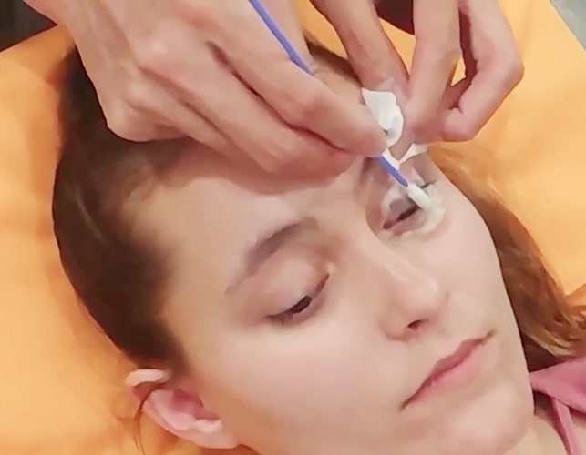 ZEST Eyelid Treatment img